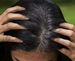 Health Tips : तेजी से सफेद होते बालों को इन उपायों से करे झट से काला