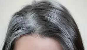 Health Tips : बढ़ते जा रहे है अगर 'सिर 'में सफेद बाल तो ये आयुर्वेदिक नुस्खे करेंगे इनको जड़ो से खत्म