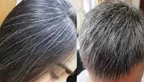 Hair care Tips- सफेद बालों से परेशान हैं, तो इन प्राकृतिक उपायों का करें इस्तेमाल