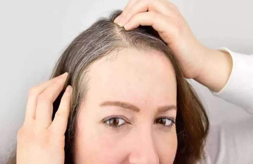 Hair Care Tips-  झड़ते और सफेद बालों से राहत दिलाएगा ये तेल, ऐसे करें तैयार