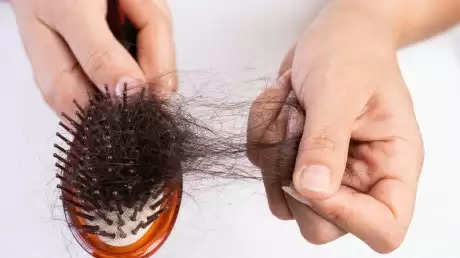 Hair Care Tips- बालों की झढ़ने की समस्या से ऐसे पाएं निजात, इस तेल का करें इस्तेमाल