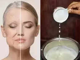 Skin Care Tips- आइए जानते हैं कि दूध का इस्तेमाल करके आप कैसे सुंदर बन सकते हैं